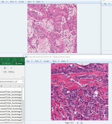 دیتاست تصاویر پزشکی برای تقسیم هسته سلولی Medical Images for Nucleus Segmentation
